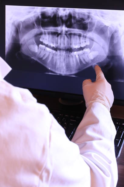 Best Emergency Root Canal Treatment in Marseles, IL